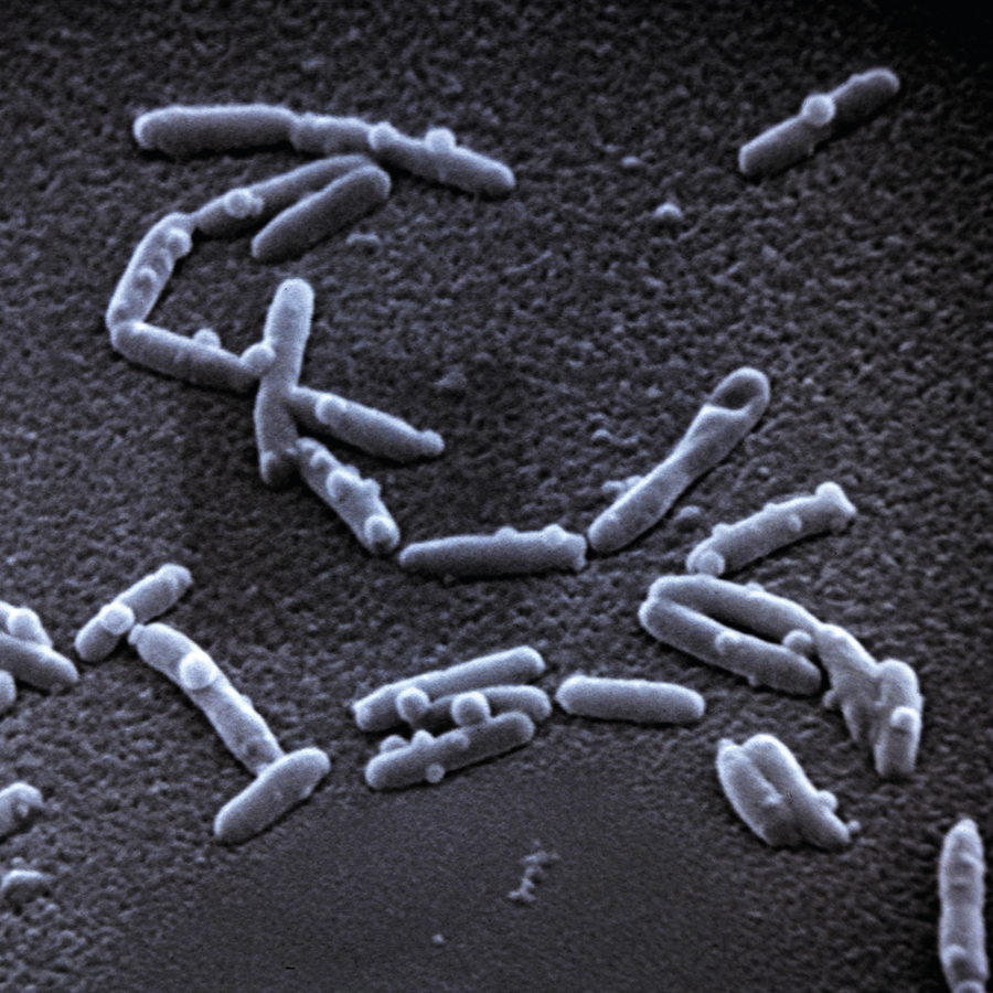 legionella